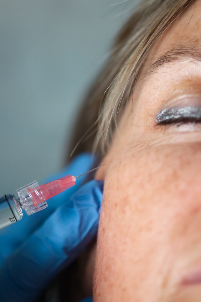 Un résultat naturel grâce à l'acide hyaluronique visage.